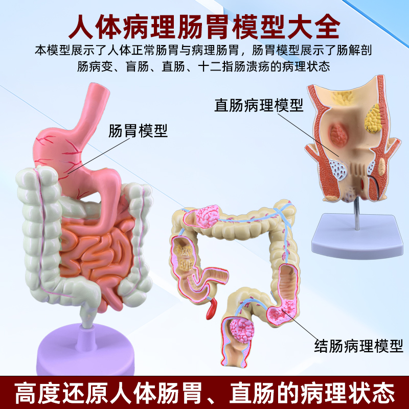人体大肠结肠结构解剖病理