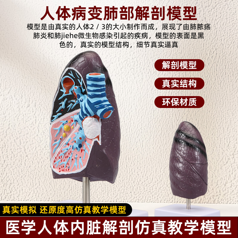 人体肺部病理病变结构解剖
