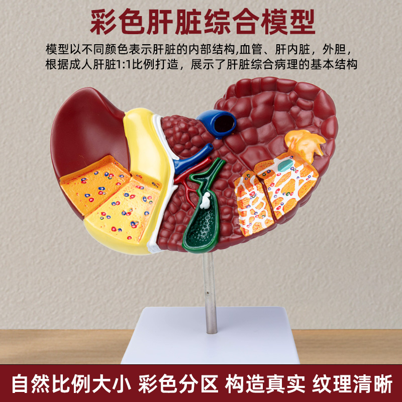 医学仿真人体肝脏解剖模型