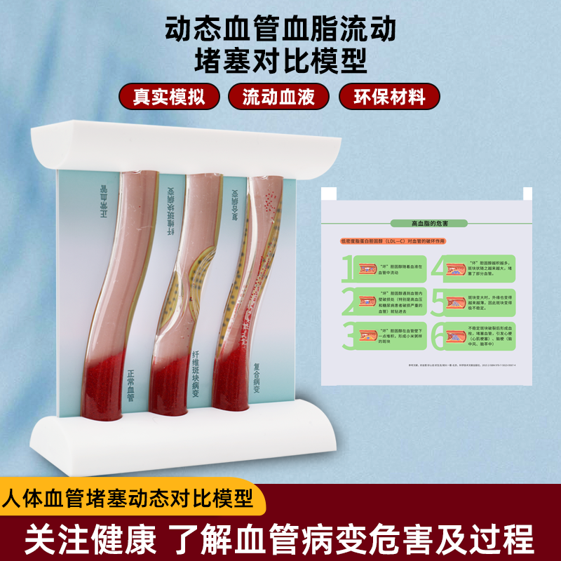 仿真动态高血脂血管堵塞对