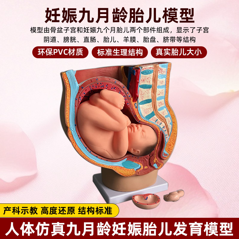 妇科女性盆腔附足月胎儿模