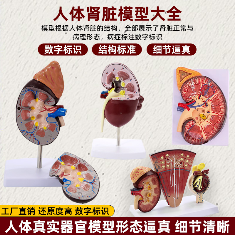 人体肾脏器官结构解剖模型