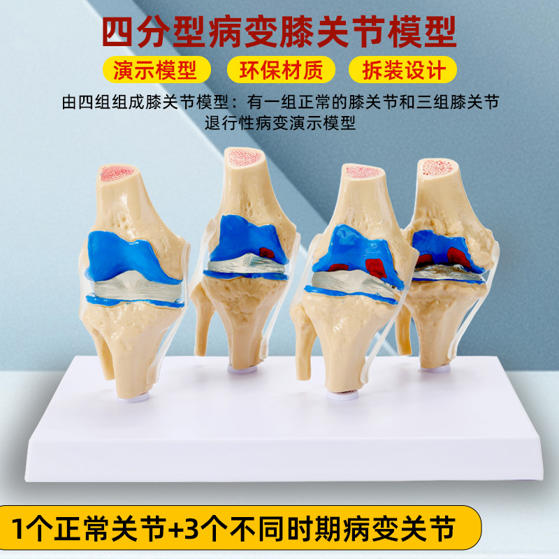 政河病理膝关节人体骨骼模