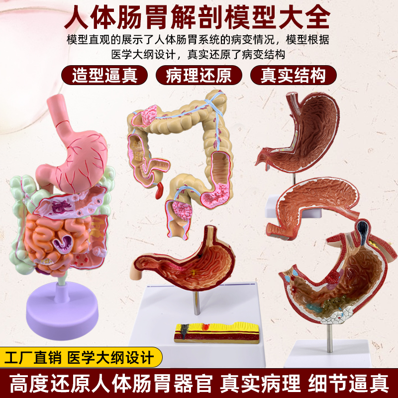 政河人体大肠病理痔疮展示