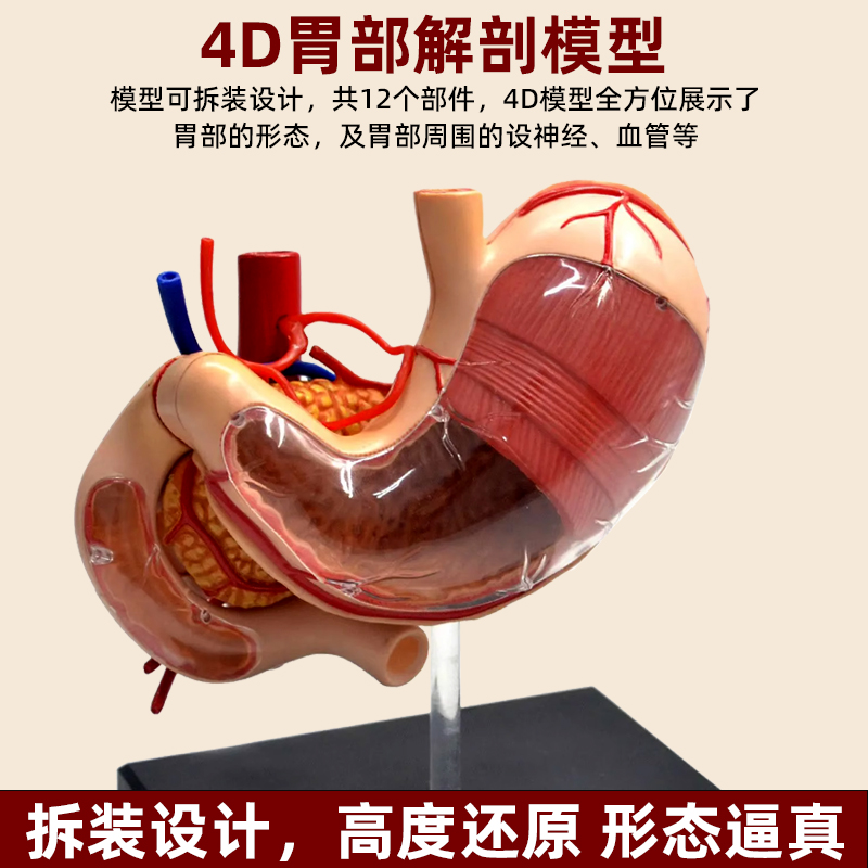 人体胃解剖模型胃的病变模