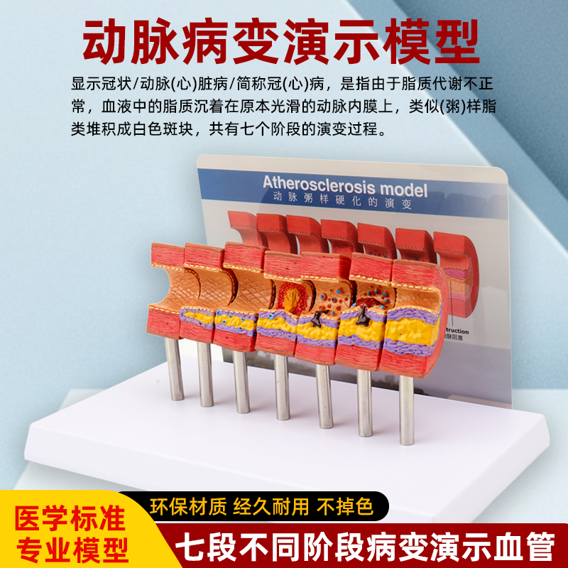 动脉粥样硬化模型血管血栓